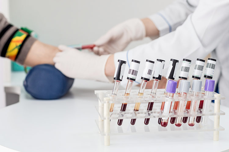 Těhotenské krevní testy | Foto: Shutterstock