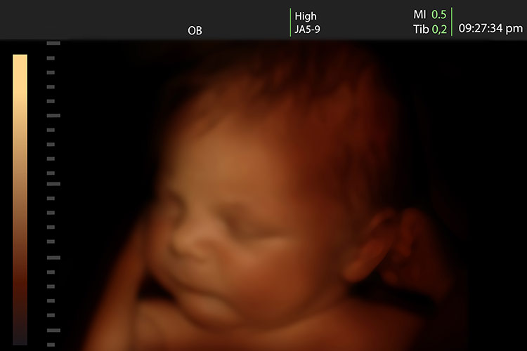3D těhotenský ultrazvuk | Foto: Shutterstock